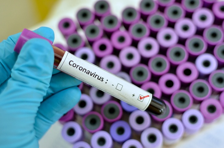 BREAKING: Ghana, Gabon record first cases of coronavirus